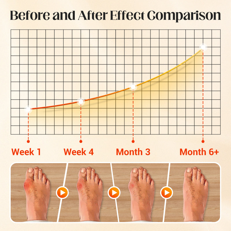 🎉BUY 2 GET 1 FREE（3pcs）✨Orthopedic Invisible Toe Socks|Summer Five-Toe Shallow Socks🌸