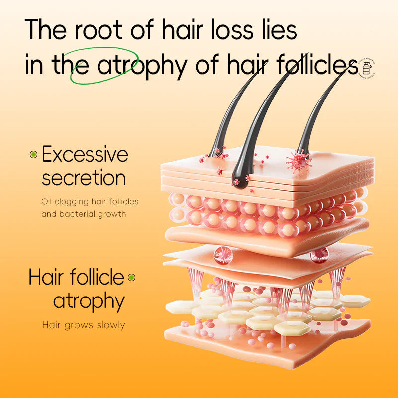 Anti Hair Loss Shampoo for Thinning Hair | Reduce Daily Shedding & Strengthen Roots | For Men & Women