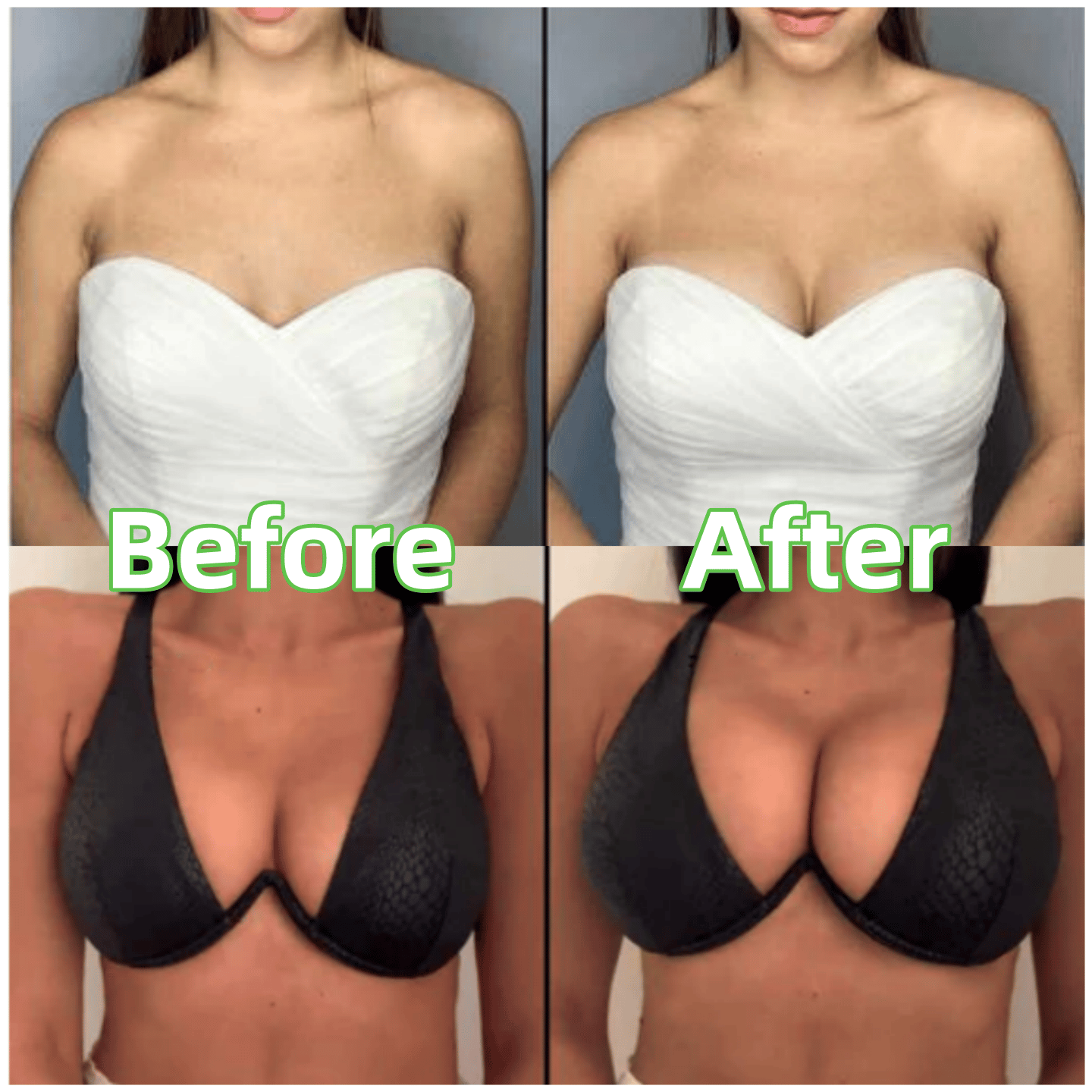 💕OUFALI Lift Inserts for Bras – Lightly Padded, Double-Sided Adhesive👙 Reusable, Washable • Natural Lift • Seamless Under Clothing ✨