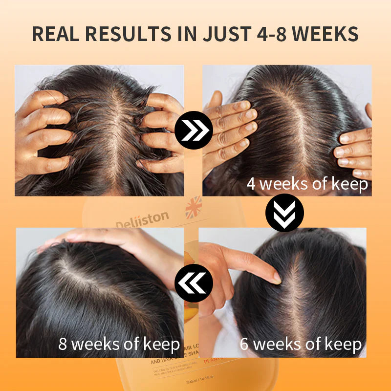 Anti Hair Loss Shampoo for Thinning Hair | Reduce Daily Shedding & Strengthen Roots | For Men & Women