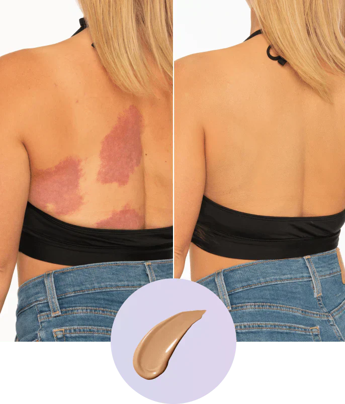 💜Last Day-Buy 1 Get 1 Free!💜✨Body Coverage Perfector – Waterproof, Lightweight & Flawless Body Makeup