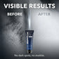 🧴 Hair Removal Cream, 100g Gentle Body Depilatory Cream for Arms, Legs, Chest & Back, with Free Spatula