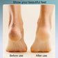 🔥Hot Sale - 45% OFF💕Rechargeable Electric Foot Callus Remover