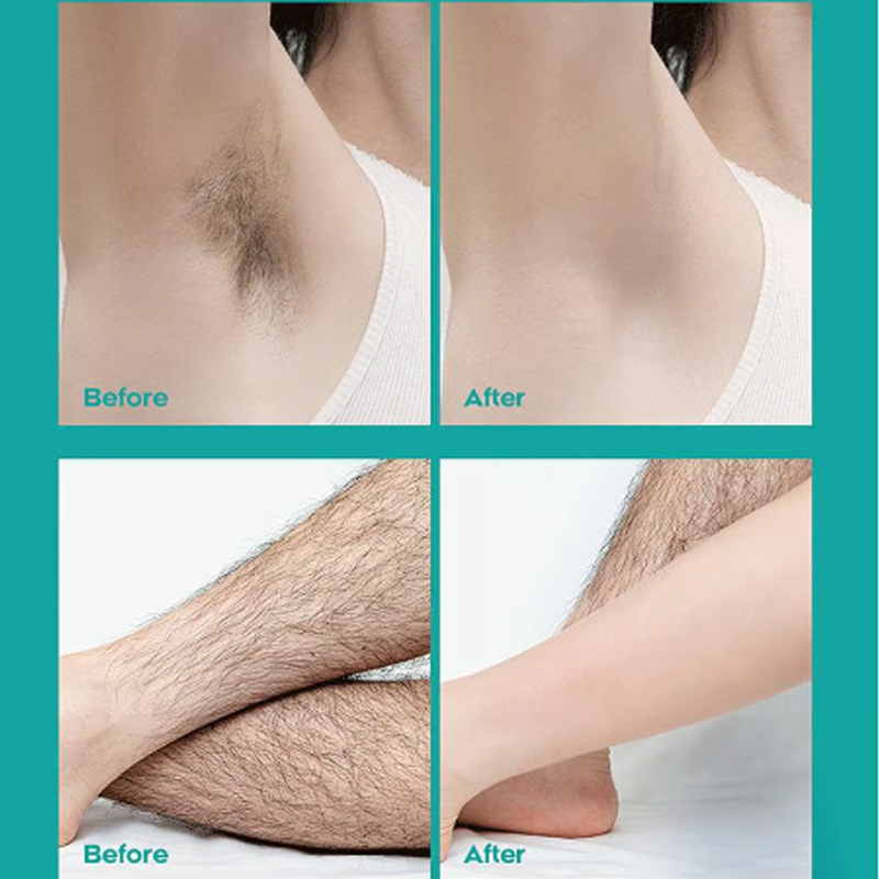 🔥Limited Sale-Buy 2 Get 1 Free!🎁Painless Full Body Hair Removal Cream 💧✨