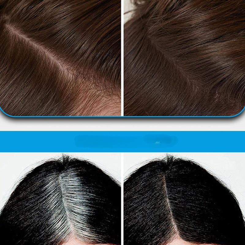 💖2026 Hot Sale💖 Multi-Functional Instant Concealer Hairline Powder