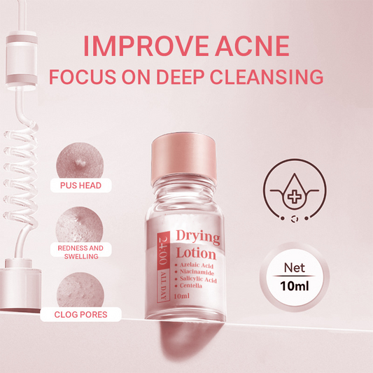 Fast-Acting Blemish Drying Lotion with Salicylic Acid | Spot Treatment for Acne & Breakouts