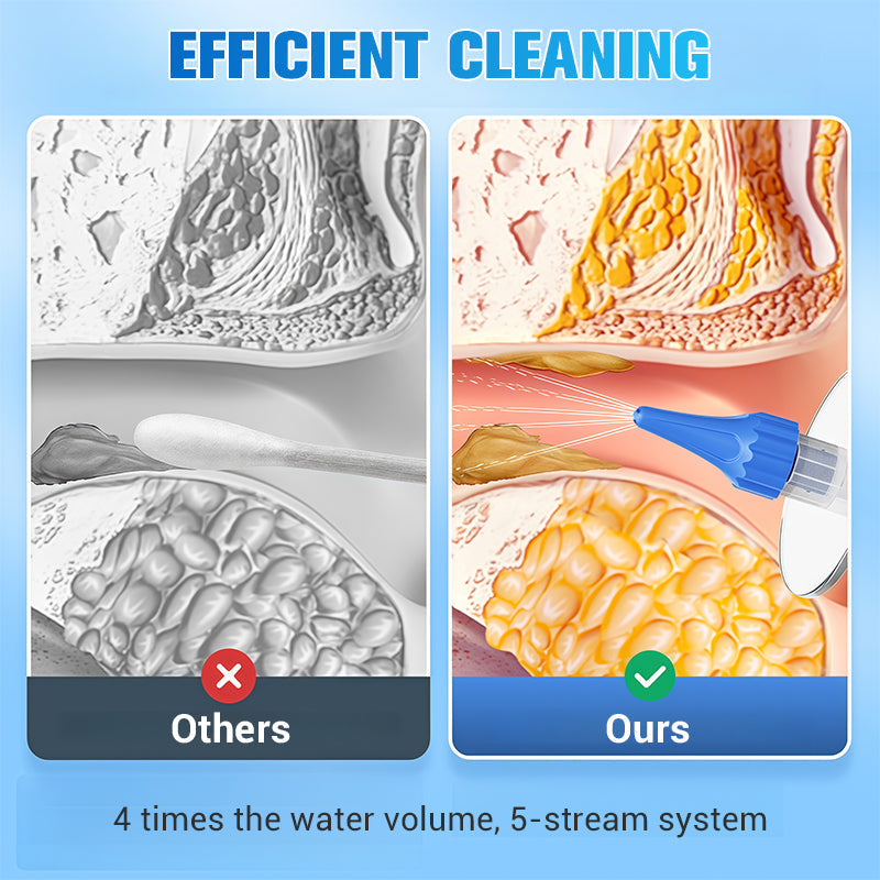 Safe & Gentle Ear Wax Removal Kit – 4x Water Volume, 5 Streams for Effective Cleaning