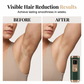 Professional IPL Laser Hair Removal Device