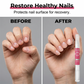 Nail Biting Prevention For Kids & Adults|Natural Bitter Agent：Vitamin E Enriched