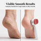 🎁Last Day Promotion 53% OFF🔥Double-Sided Foot Scraper for Callus Removal