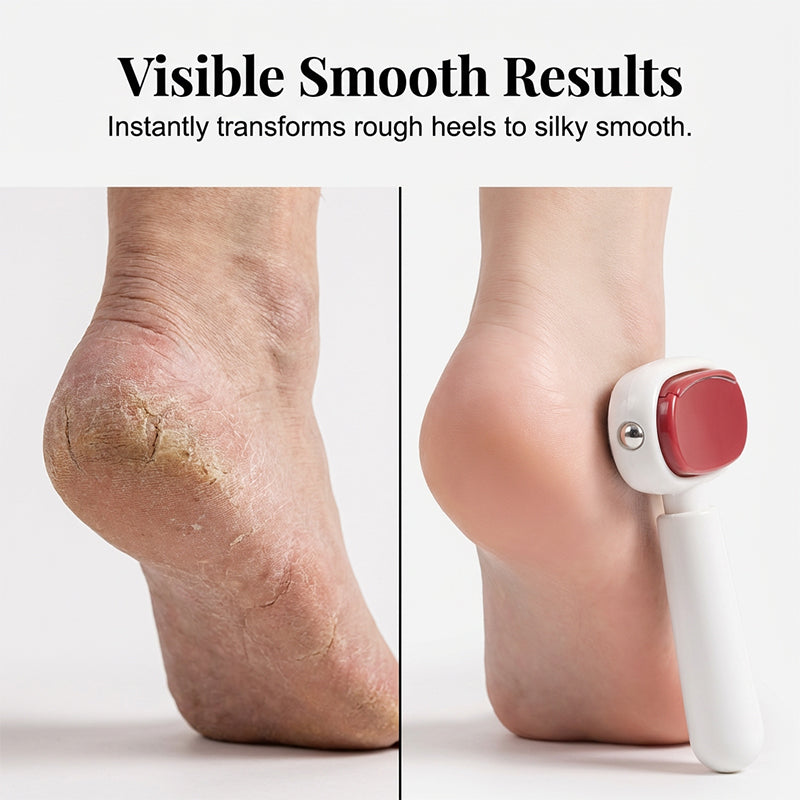 🎁Last Day Promotion 53% OFF🔥Double-Sided Foot Scraper for Callus Removal
